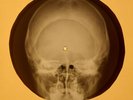 Beatles - Twist And Shout  X-RAY OF USSR X-RAY BONE RECORDING