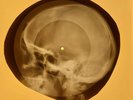 Elvis Presley - Hound Dog X-RAY OF THE USSR X-RAY BONES RECORDING