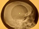 Jackie Wilson - Night X-RAY OF THE USSR X-RAY BONES RECORDING