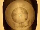 Rivieras - California Sun X-RAY OF THE USSR X-RAY BONE RECORDING