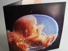 Motrip ‎– Embryo (2LP Gatefold Reissue Germany 2017) Marsimoto