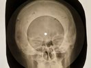 Velvet Underground - Black Angel's Death Song X-RAY OF USSR X-RAY BONE RECORD