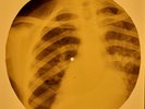 Robert Gordon - Sea Cruise X-RAY OF USSR X-RAY BONES RECORDING