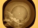 Alice Cooper - Under My Wheels X-RAY OF THE USSR X-RAY BONE RECORD
