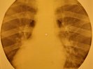 Beatles - Let It Be X-RAY OF THE USSR X-RAY BONES RECORDING