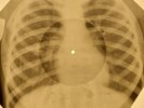 Rolling Stones - Paint It Black X-RAY OF USSR X-RAY BONES RECORD