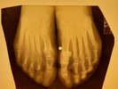 Led Zeppelin - Communication Breakdown X-RAY OF USSR X-RAY BONE RECORD