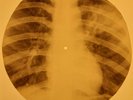 Beatles - Girl X-RAY OF THE USSR X-RAY BONES RECORD
