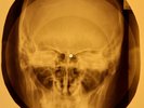 Rolling Stones - Rip This Joint  X-RAY OF THE USSR X-RAY BONES RECORD