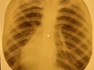 Doors - Unknown Soldier X-RAY OF USSR X-RAY BONES RECORD