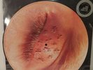 The Mars Volta – Inertiatic ESP Picture Disc Vinyl 1 of 5000 made