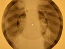 Jackie Wilson - Reet Petite X-RAY OF USSR X-RAY BONES RECORDING