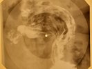 Blue Swede - Hooked On A Feeling X-RAY OF USSR X-RAY BONES RECORD