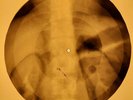 Chubby Checker - Let's Twist Again X-RAY OF USSR X-RAY BONES RECORDING