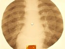 Kinks - You Really Got Me  X-RAY OF THE USSR X-RAY BONES RECORDS
