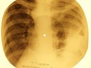 Johnny Cash - Thanks A Lot  X-RAY OF USSR X-RAY BONE RECORD