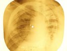 Elvis Presley - Rip It Up  X-RAY OF THE USSR X-RAY BONES RECORDS