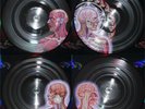 Tool - Lateralus [2-lp Picture Disc] Vinyl LP Album