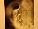 Elvis Presley - Surrender X-RAY OF THE USSR X-RAY BONES RECORD