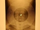Rolling Stones - Stoned X-RAY OF THE USSR X-RAY BONES RECORDING