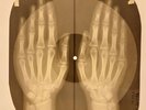 Rolling Stones - Paint It Black X-RAY OF USSR X-RAY BONES RECORDS