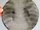 USSR X-RAY BONE Record Pyotr Leshchenko / Tatiana - 8.7” 78 RPM 1955 Rary