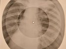 Rolling Stones - Heart of stone X-RAY BONES RECORDS USSR 16