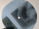 BEATLES OBLADI OBLADA X-Ray USSR Record Roentgen Bones RIBS Music Vinyl