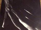 Milton Nascimento - Milagre Dos Peixces Rare Vinyl Album, Brasil 1973
