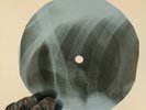 SEEKERS MORNING TOWN RIDE X-Ray USSR Record Roentgen Bones Ribs Music Vinyl