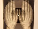 Elvis Presley - Echoes Of Love  X-RAY HANDS BONES RECORDS USSR 290