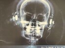 DJ Z-Trip & DJ P Uneasy Listening Vol1