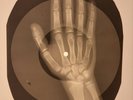 Beatles - Help  X-RAY HAND BONES RECORDS USSR 320