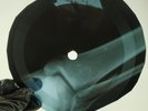 ELVIS PRESLEY SURRENDER X-Ray USSR Record Roentgen Bones Ribs Music Vinyl