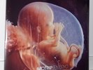MoTrip - Embryo (Vinyl LP NEU / MINT / SEALED)