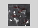 Duran Duran Danse Macabre Translucent Galaxy Vinyl + CD + signed print presale