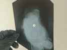 LED ZEPPELIN BLACK MOUNTAIN X-Ray USSR Record Roentgen Bones Ribs Music Vinyl