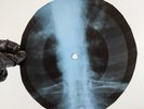 DAVID BOWIE ALL THE MADMEN X-Ray USSR Record Roentgen Bones Ribs Music Vinyl