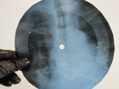 PINK FLOYD PAINT BOX X-Ray USSR Record Roentgen Bones Ribs Music Vinyl