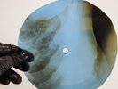 DAVID BOWIE I'M NOT LOOSING X-Ray USSR Record Roentgen Bones Ribs Music Vinyl