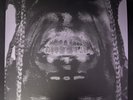 TRAVIS SCOTT “UTOPIA” 2x TRANSLUCENT LP SET