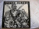 Broken Bones : Dem Bones  Vinyl LP - 1984 FALL LP 028  VG  Punk 'Oi'  RARE PRESS