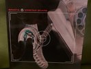 SPARTA - WIRETAP SCARS LP Red Vinyl RARE LIMITED EDITION, Excellent  Rare