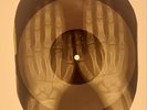 X-RAY USSR  ROENTGEN BONES RECORD ORIGINAL OLD RIBS 625