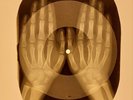 X-RAY USSR  ROENTGEN BONES RECORD ORIGINAL OLD RIBS 641