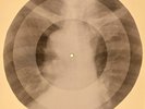 78 rpm X-RAY USSR ROENTGEN BONES RECORD ORIGINAL OLD RIBS 621