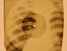 X-RAY USSR ROENTGEN BONES RECORD 78 rpm ORIGINAL OLD RIBS 638