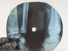 ELVIS PRESLEY SURRENDER X-Ray USSR Record Roentgen Bones Ribs Music Vinyl