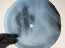 DON PARTRIDGE ROSIE X-Ray USSR Record Roentgen Ribs Bone Music Vinyl