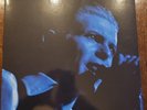 David Bowie  - RAREST ONE BOWIE - LIGHT BLUE VINYL - LIMITED PRESSING
